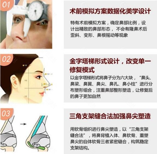 北京黄寺杜太超隆鼻修复手术优势