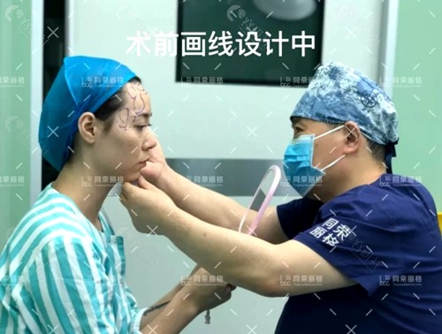 杭州同荣丽格医疗美容院长郭同荣自体脂肪填充全脸术前画线