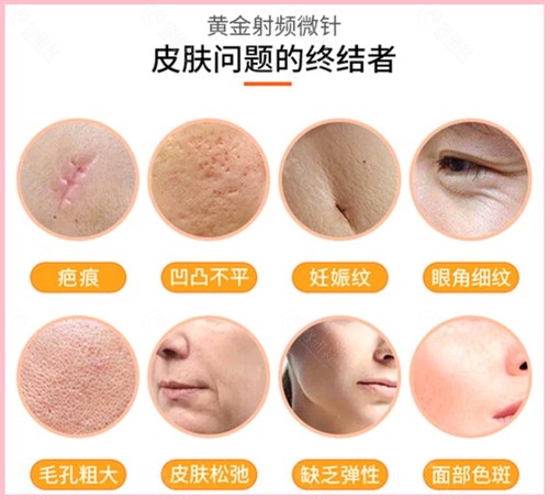 黄金微针可以解决皮肤哪些问题？北京人气高的十大皮肤医院排名来了