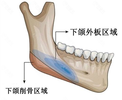 下颌角区域示意图