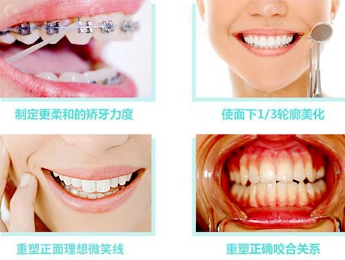 牙齿矫正的流程