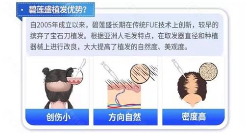 深圳碧莲盛植发优势