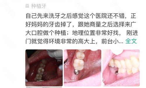 牙友带妈妈在广州广大口腔医院做种植牙口碑点评