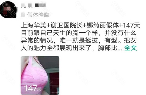 上海谢卫国娜绮丽隆胸术后评价