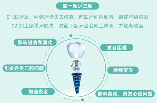 北京钛植口腔种植牙优势