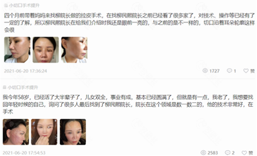 北京华韩医疗美容医院做面部拉皮除皱求美者口碑反馈