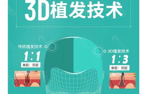 北京新生3D植发技术怎么样？