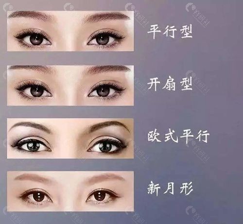 双眼皮常见几种形状