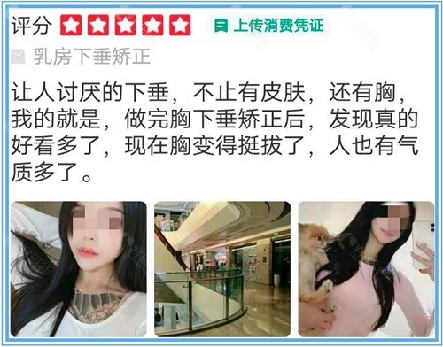 重庆美仑美奂乳房内下垂矫正术后评价