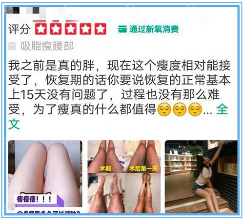 义乌连天美医疗美容腰腹吸脂真实评价