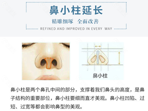 鼻小柱延长技术