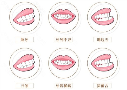 上海九院牙齿矫正多少钱