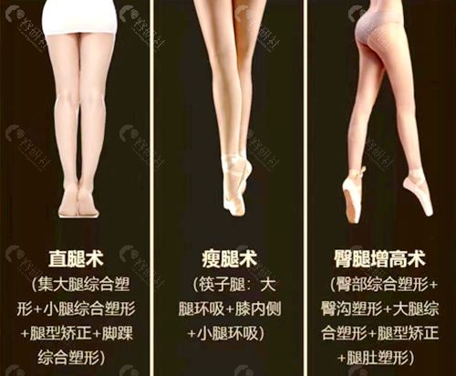北京达美如艺谷廷敏医生O型腿矫正、直腿术、瘦腿术、臀腿增高术价格