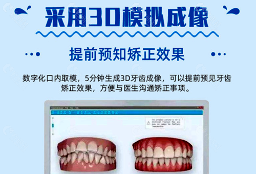 南京美奥口腔医院3D模拟成像预知矫正结果