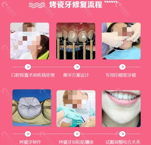 重庆众植博仕口腔烤瓷牙修复流程介绍