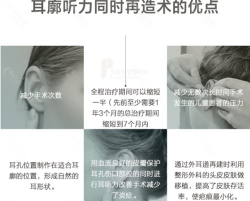 韩国普罗菲耳耳再造和听力重建一起做的优势