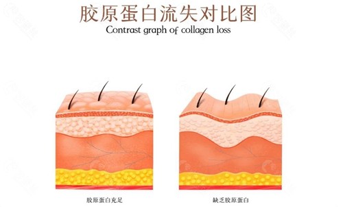 胶原蛋白流失对比图