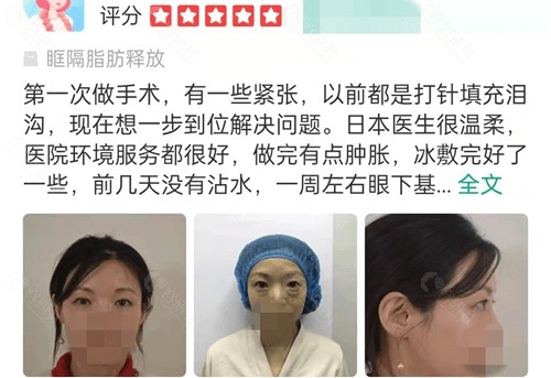 北京领医日式整形医院祛眼袋评价
