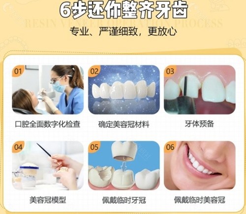杭州薇琳医疗美容口腔医院看牙优势介绍