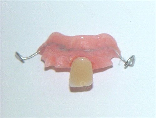 北京义齿修复、种植牙修复收费价格表