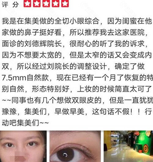 郑州集美整形双眼皮术后评价