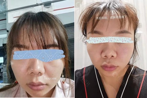 上海薇琳医疗美容医院做美容护肤前后对比照