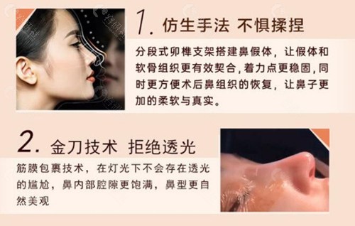 南京美贝尔隆鼻技术优势介绍