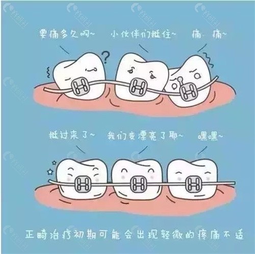 贵阳市口腔医院牙齿矫正贵吗