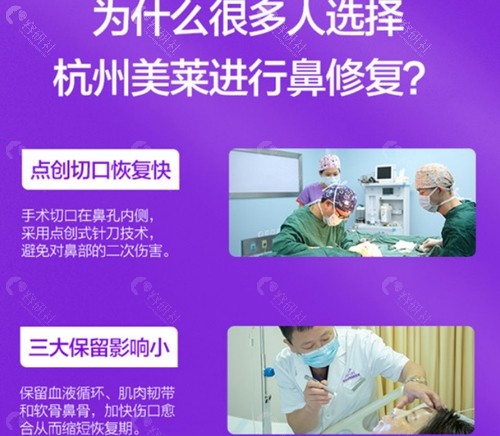 杭州美莱隆鼻修复手术优势介绍