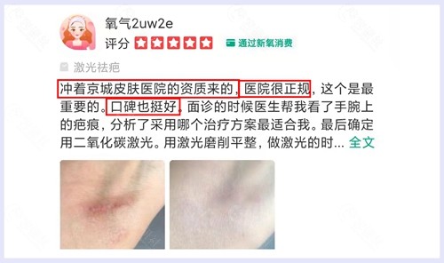 北京京城皮肤医院去疤痕前后对比照