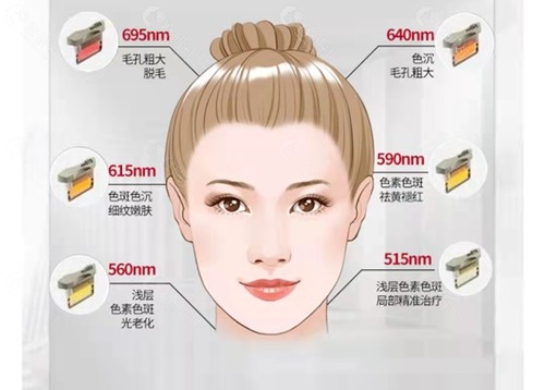 北京新星靓做光子嫩肤技术好吗？