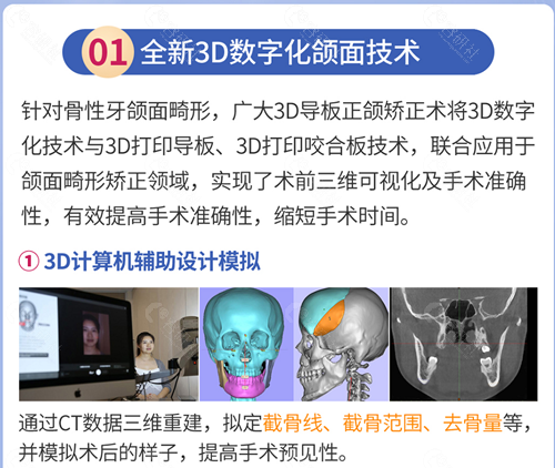 广大医院3D数字化颌面技术