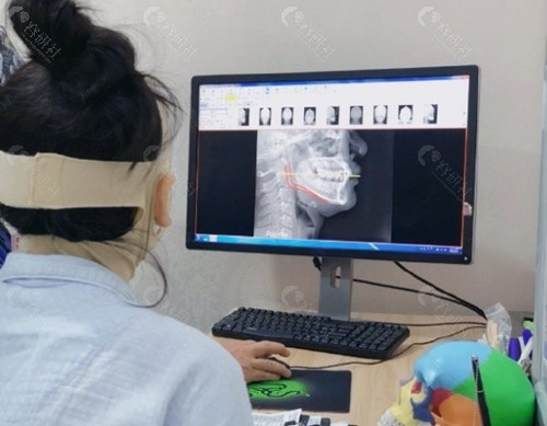 上海首尔丽格朴兴植通过x-ray光片和求美者确认术后的样子