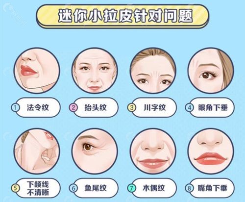 北京美媛荟医疗美容迷你小拉皮可以解决的面部问题