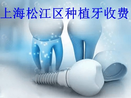 上海松江区种植牙2022收费价目表