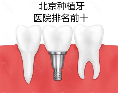 北京种植牙医院排名前十