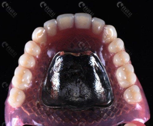 全口义齿的缓冲区图片图片