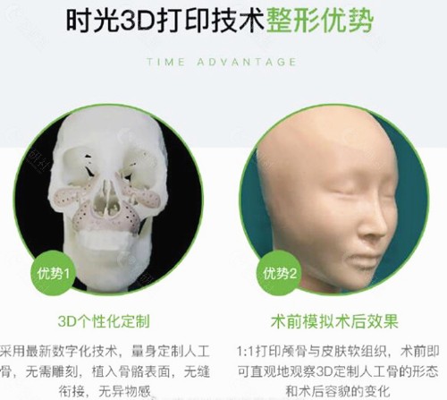 杭州时光3D打印技术整形优势介绍