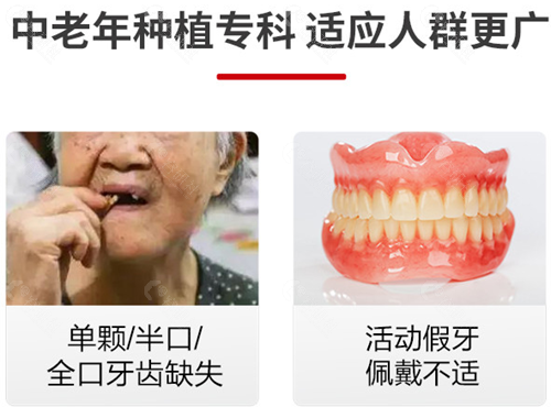 北京美冠塔口腔种植牙适应人群