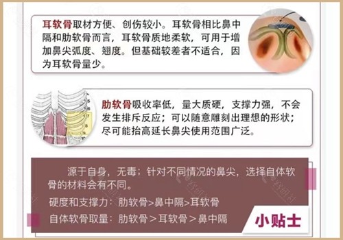 张龙隆鼻技术好