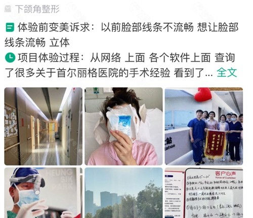 整友在上海首尔丽格整形医院做下颌角手术口碑评价