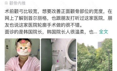 整友在上海首尔丽格整形医院做颧骨手术的口碑评价
