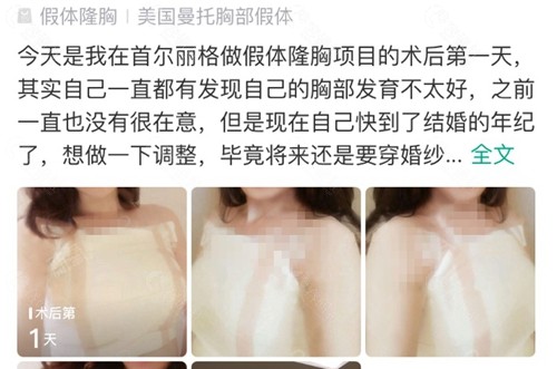 整友在上海首尔丽格整形医院做假体隆胸口碑评价