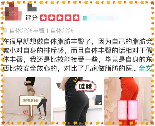 北京东方和谐常双明自体脂肪填充臀部评价