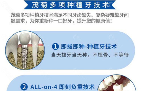 上海茂菊口腔种植牙技术优势
