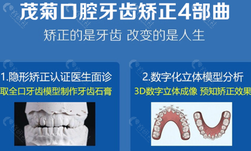 上海茂菊口腔牙齿矫正步骤
