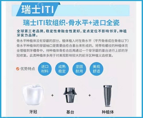 西安团圆口腔医院种植牙技术优势