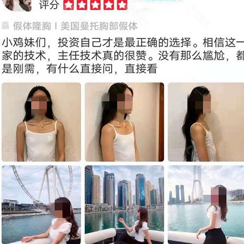 上海艺星隆胸术后反馈