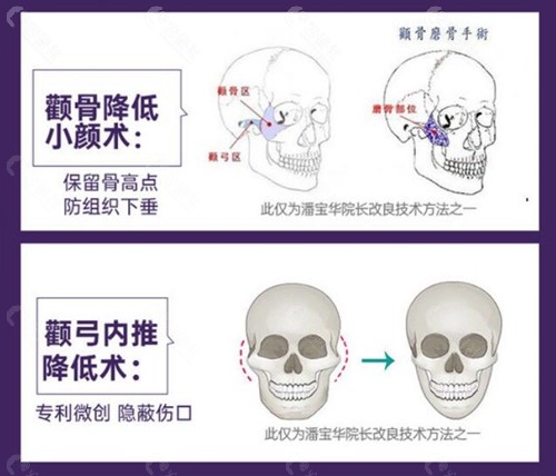 广州美恩技术优势介绍