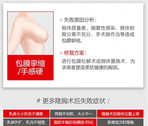 上海时光隆胸修复优势介绍